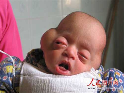 北京助孕官网_供卵试管婴儿哪家好_试管婴儿在试管多长时间放入母体_做一个试