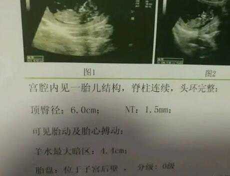 北京都有哪些助孕机构 北京试管医院排名（北京试管医院排行榜） ‘五个月彩